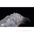 Zirconia crown